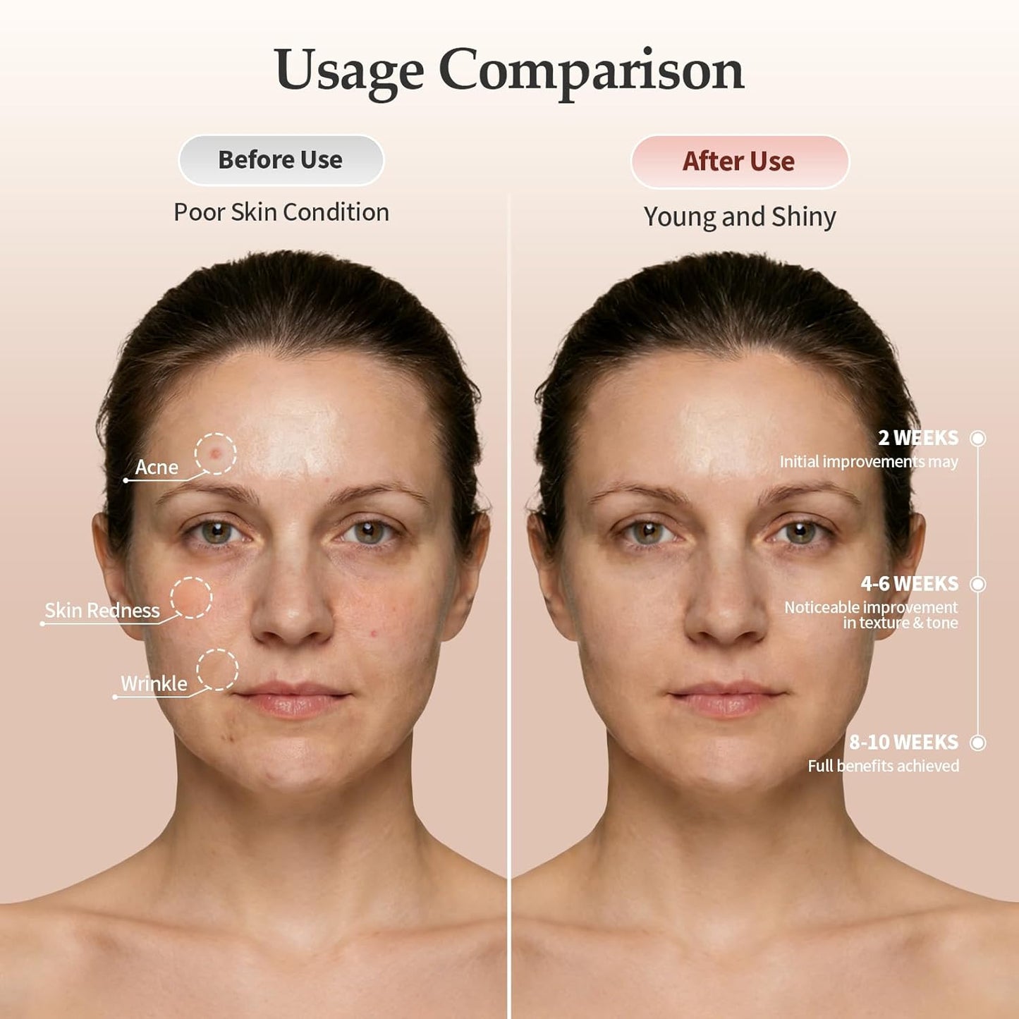 Ravlumi Pro Face Mask (1072nm) — Silicone LED Mask, 6 Beauty Modes