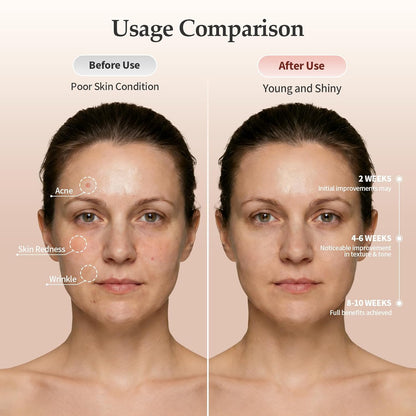 Ravlumi Pro Face Mask (1072nm) — Silicone LED Mask, 6 Beauty Modes